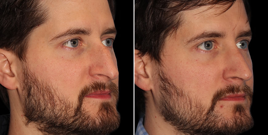 Plastic Surgery Results